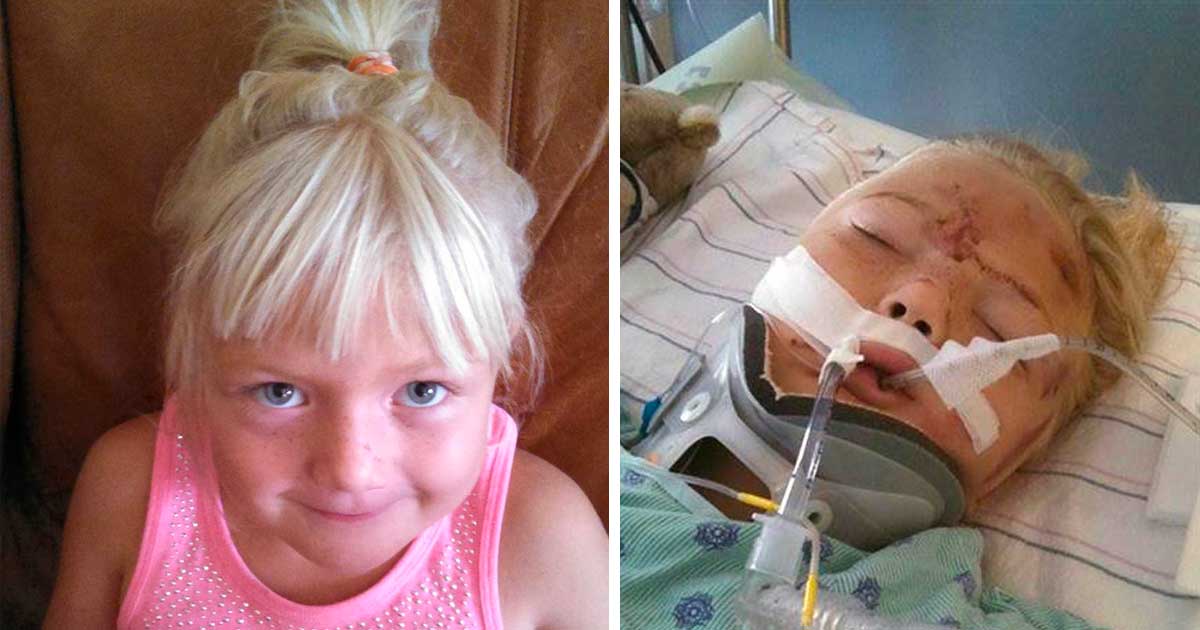 Mother warns parents not to let strangers kiss babies after her daughter is almost killed by 